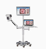 Video Colposcope C3A