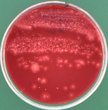 RapidGrowthBK agar (12ml)